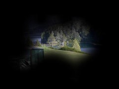 Glaucoma Muito Avançado